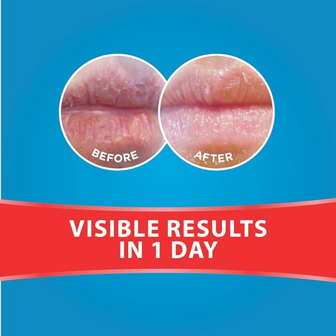 Dermal Therapy Lip Balm Stick 4.8g
