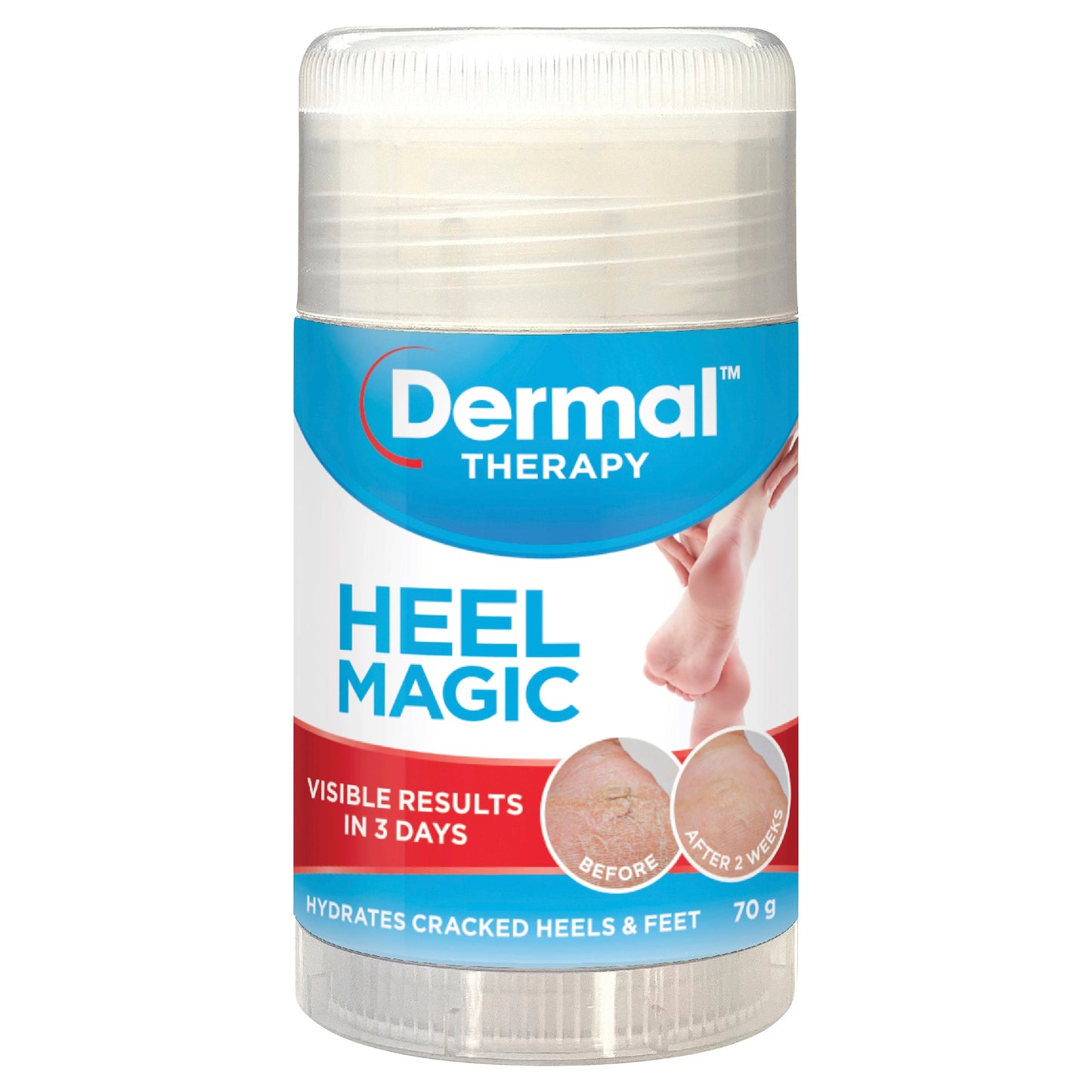 DERMAL THERAPY Roll On Heel Magic 70g