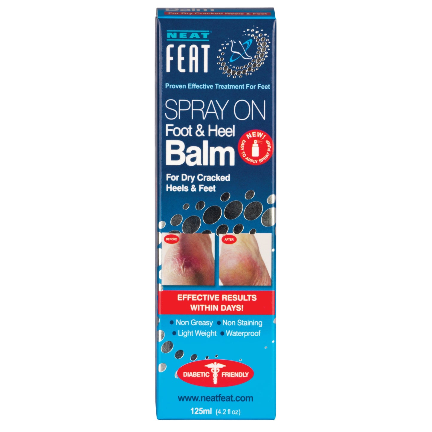 Neat Feat Foot & Heel Balm Spray 125ml
