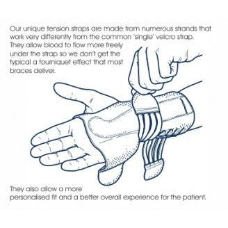 M-BRACE AIR LACED WRIST SPLINT
