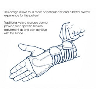 M-BRACE AIR LACED WRIST SPLINT