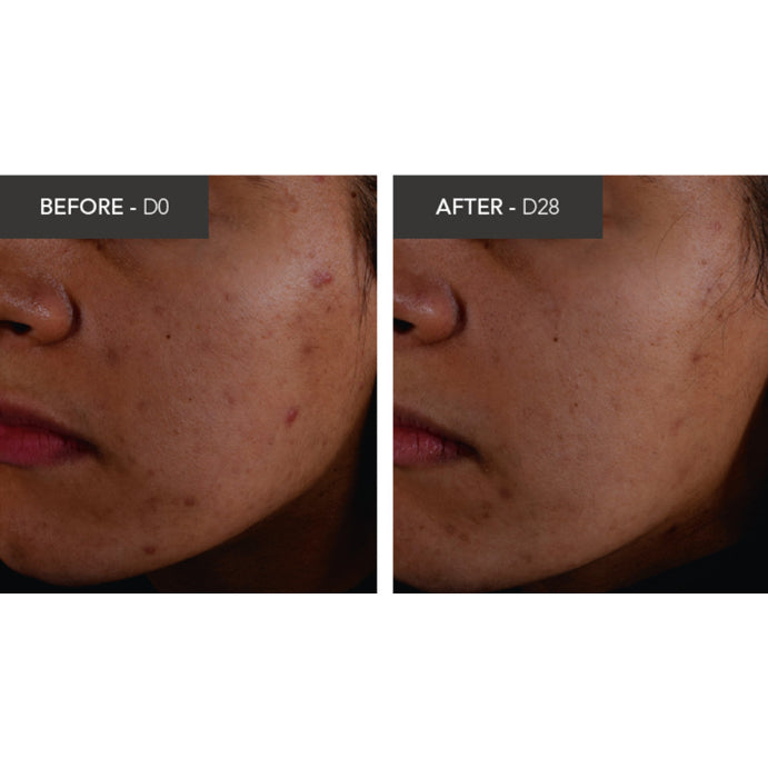 Bioderma Sébium Kerato+ Anti-blemish Gel Cream 30ml