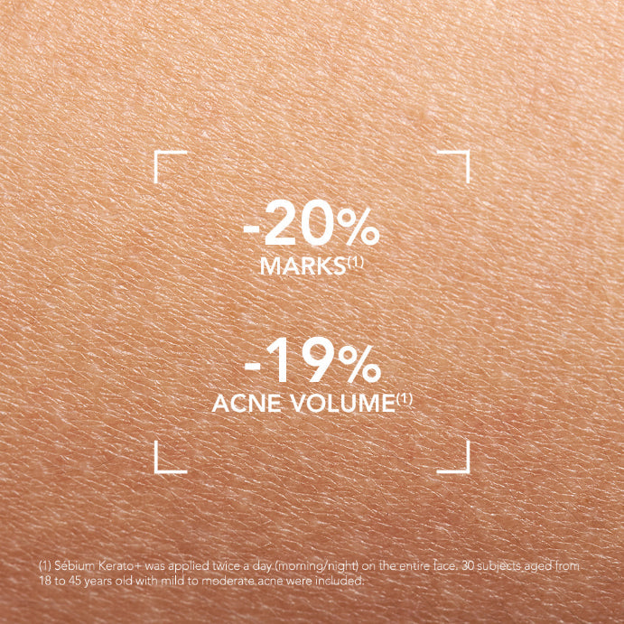 Bioderma Sébium Kerato+ Anti-blemish Gel Cream 30ml