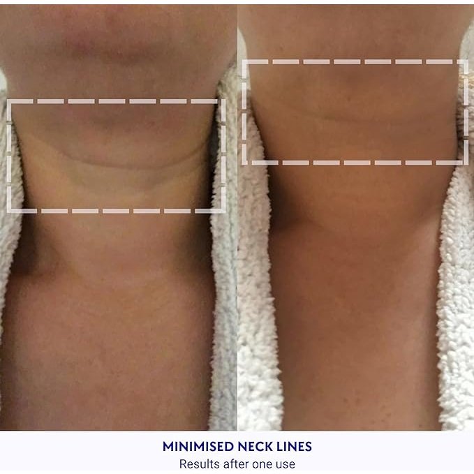 Wrinkles Schminkles Neck Wrinkle Patch Single