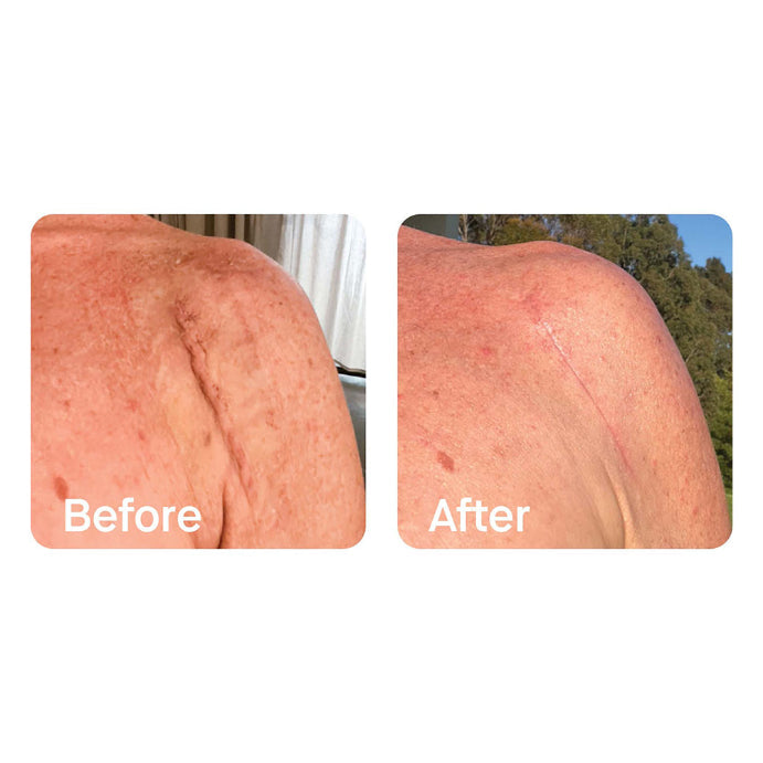 Etto Australia Skin Balm 80g