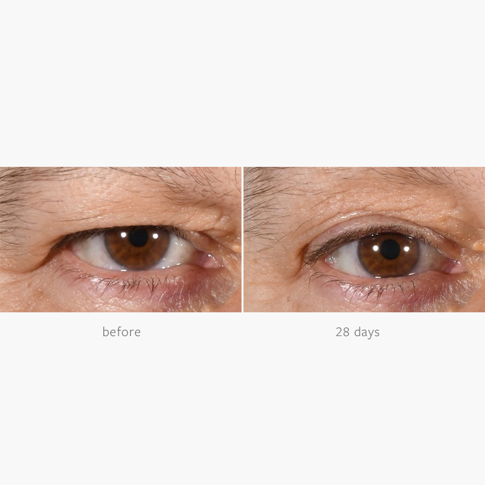 Freezeframe Non-surgical Eyelid Lift 15ml