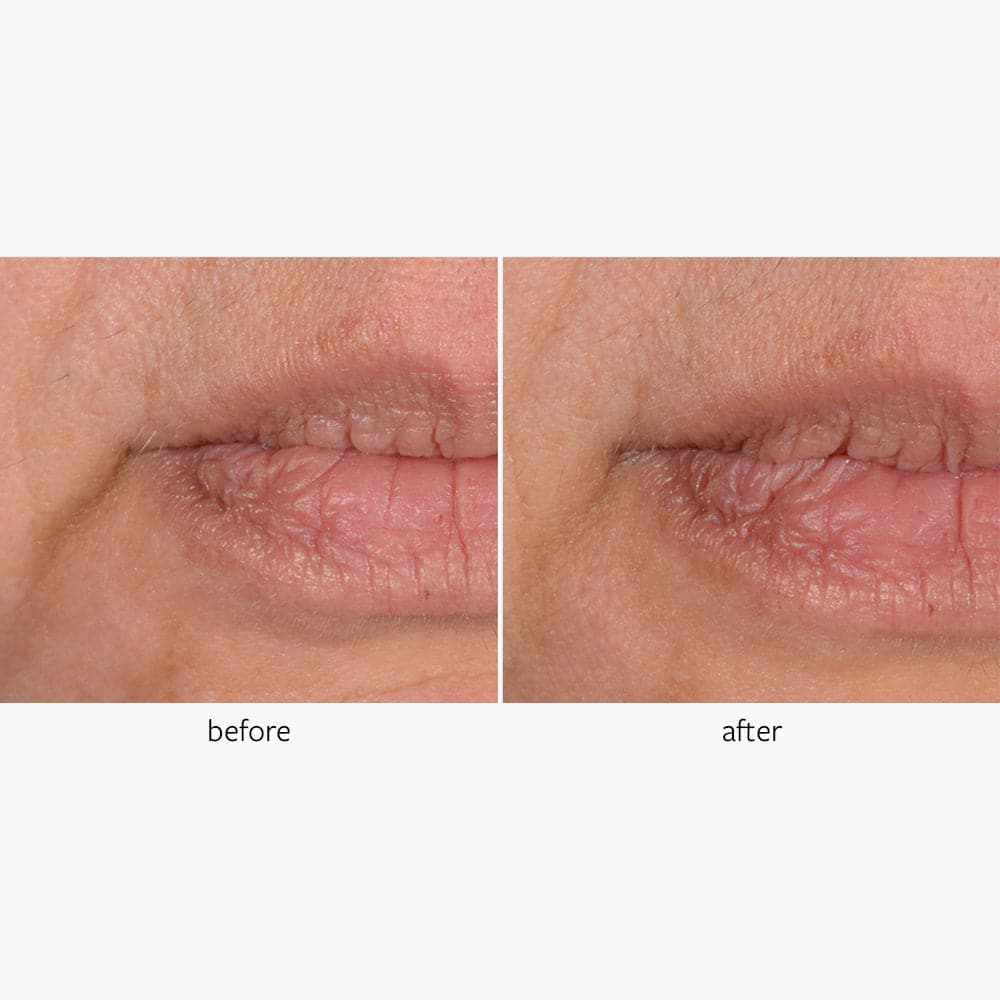 Freezeframe Wrinkle Block 30g